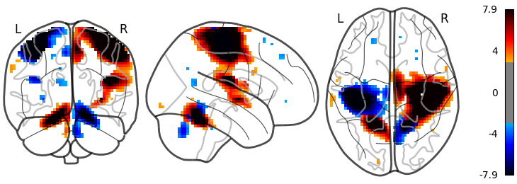 plot demo glass brain extensive