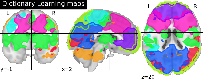 ../_images/sphx_glr_plot_extract_regions_dictlearning_maps_0011.png