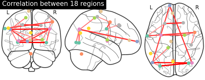 connectome