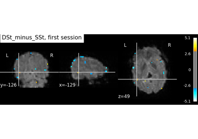 Example of explicit fixed effects fMRI model fitting