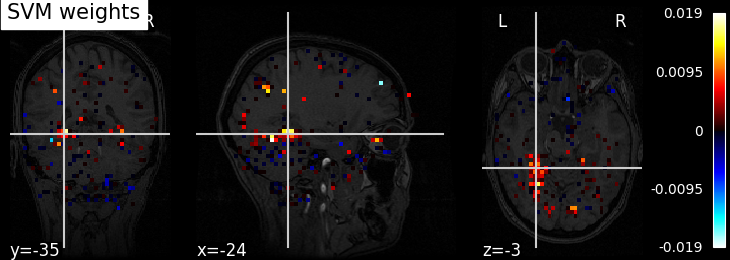 ../_images/sphx_glr_plot_haxby_anova_svm_0011.png