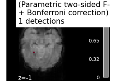 Massively univariate analysis of face vs house recognition