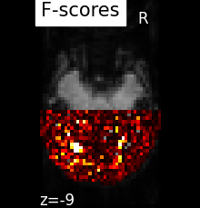 ../_images/sphx_glr_plot_haxby_searchlight_0021.png