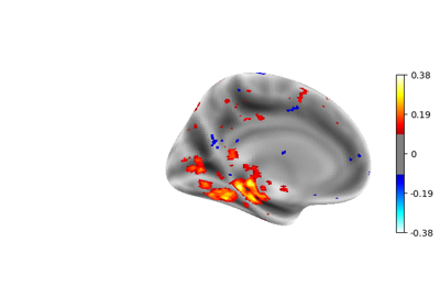 Cortical surface-based searchlight decoding