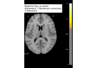 Massively univariate analysis of a motor task from the Localizer dataset