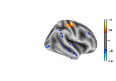 Example of surface-based first-level analysis