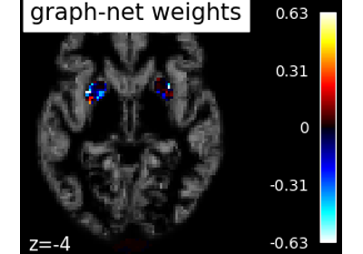 Voxel-Based Morphometry on Oasis dataset with Space-Net prior