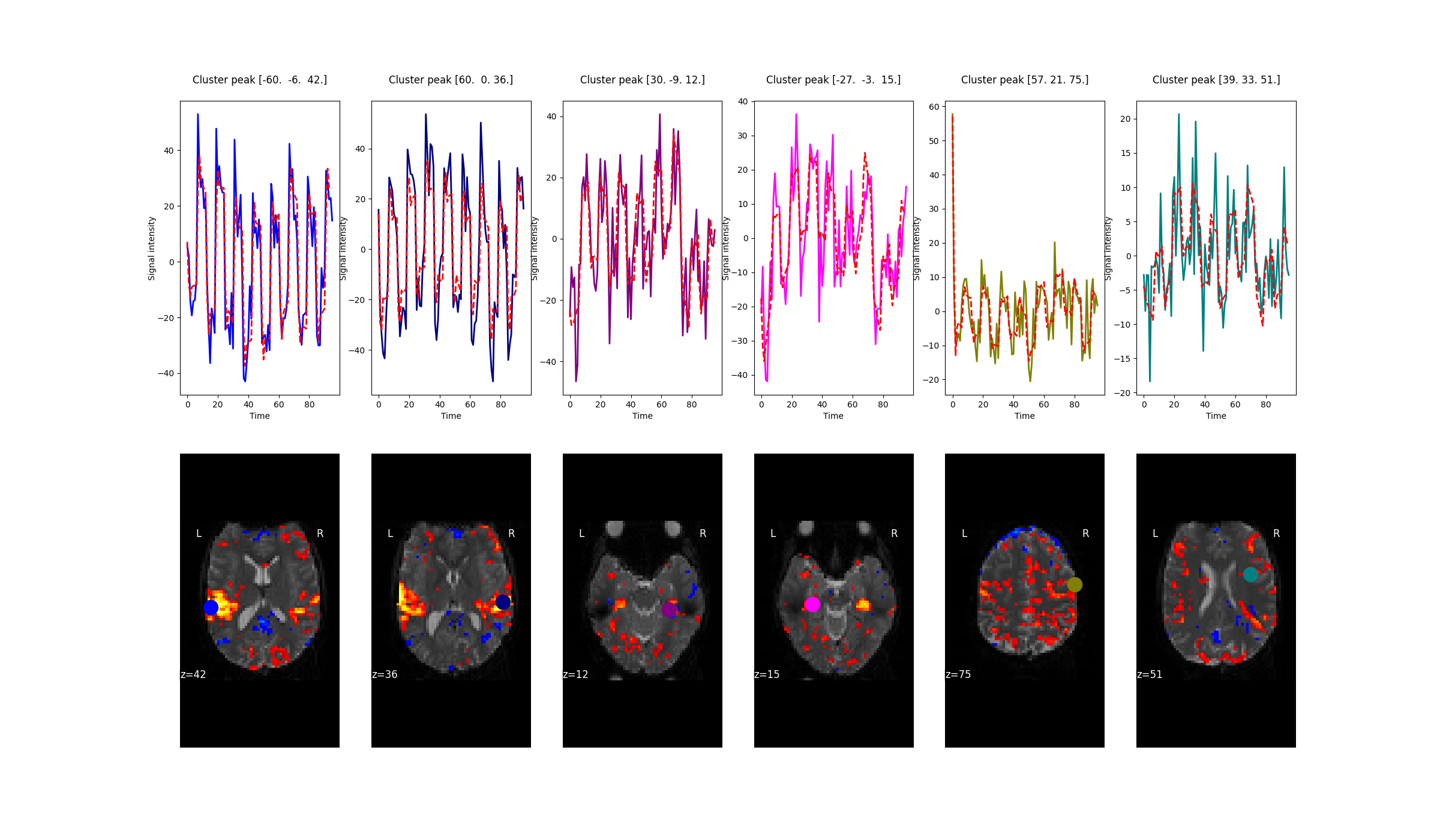 Cluster peak [-60.  -6.  42.] , Cluster peak [60.  0. 36.] , Cluster peak [30. -9. 12.] , Cluster peak [-27.  -3.  15.] , Cluster peak [57. 21. 75.] , Cluster peak [39. 33. 51.]