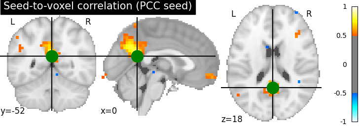 plot seed to voxel correlation