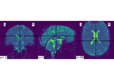 Intro to GLM Analysis: a single-session, single-subject fMRI dataset