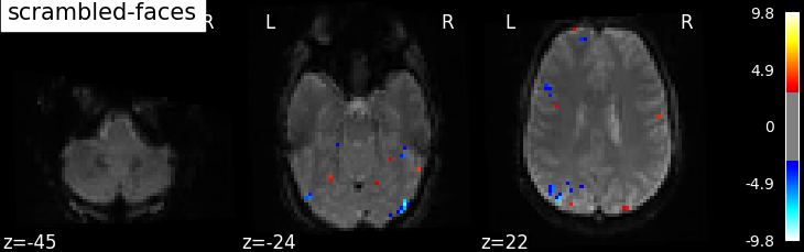 ../_images/sphx_glr_plot_spm_multimodal_faces_0021.png