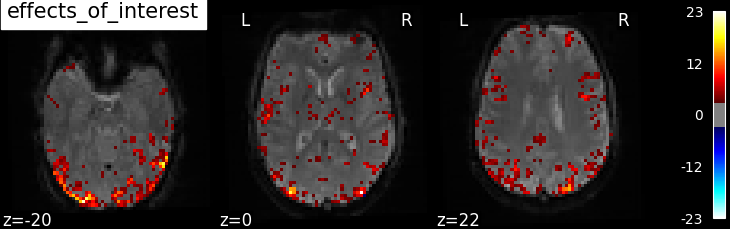 ../_images/sphx_glr_plot_spm_multimodal_faces_0031.png