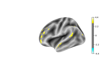 Surface-based dataset first and second level analysis of a dataset