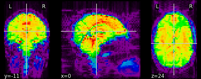 plot visualization