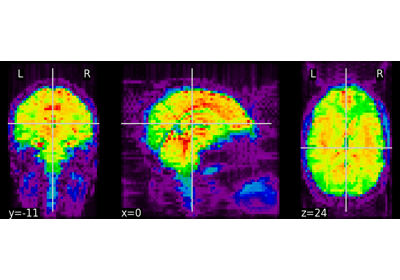 NeuroImaging volumes visualization