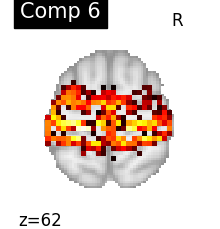 plot compare decomposition