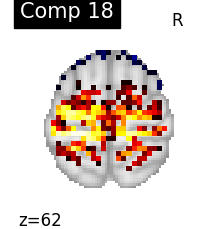 plot compare decomposition