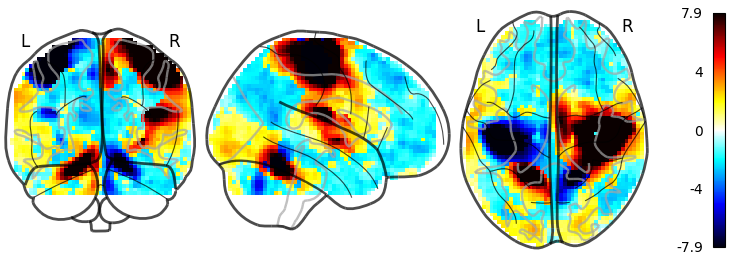 plot demo glass brain extensive