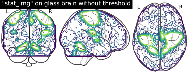 plot demo glass brain extensive