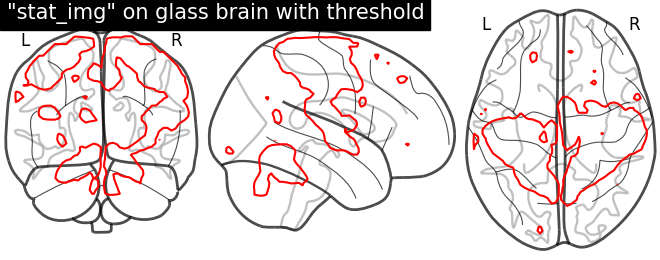 plot demo glass brain extensive