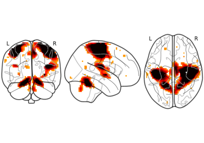 Glass brain plotting in nilearn (all options)