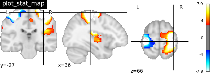 plot_stat_map