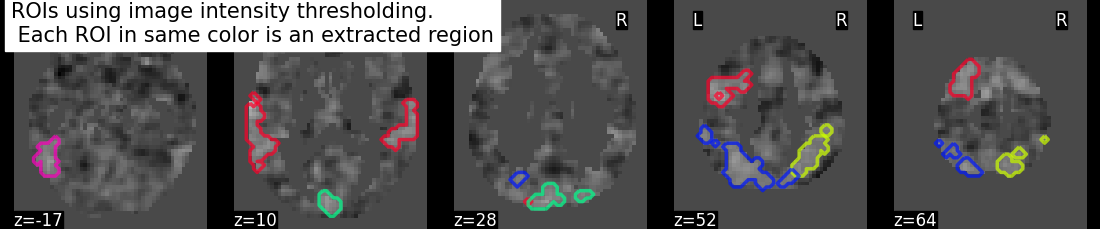 plot extract rois statistical maps