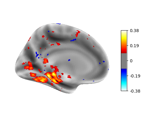 Accuracy map, left hemisphere