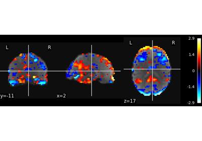 Multivariate decompositions: Independent component analysis of fMRI