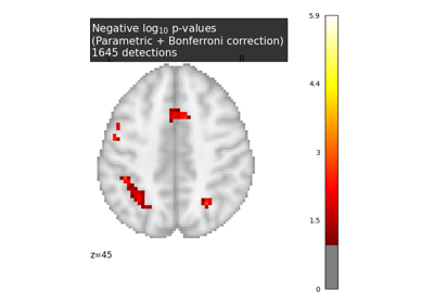 Massively univariate analysis of a calculation task from the Localizer dataset