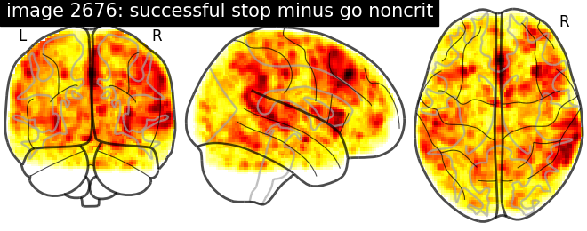 plot neurovault meta analysis