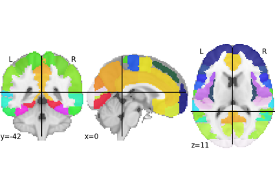 Extracting signals from brain regions using the NiftiLabelsMasker