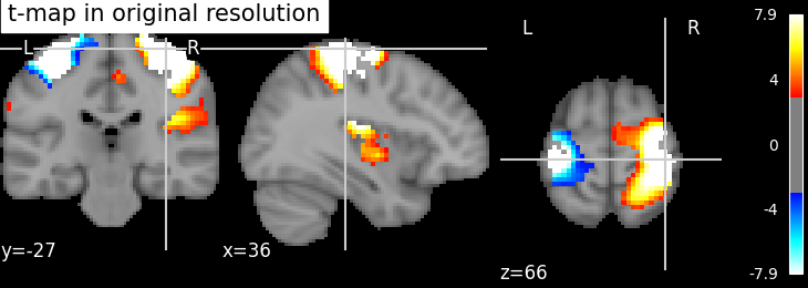 ../_images/sphx_glr_plot_resample_to_template_001.png