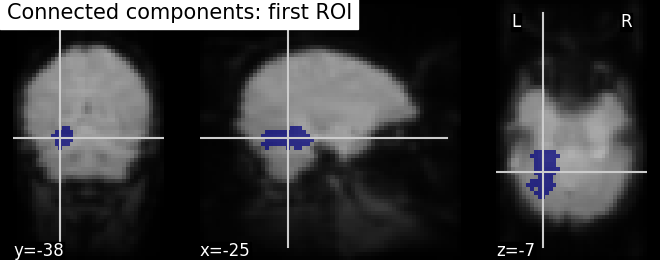 plot roi extraction