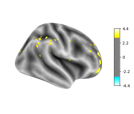 language-string, right hemisphere