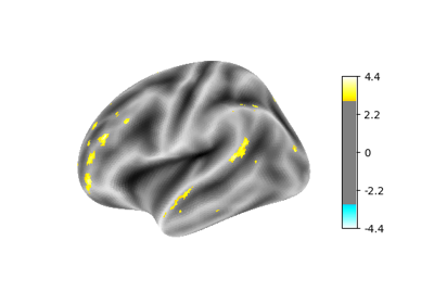 Surface-based dataset first and second level analysis of a dataset