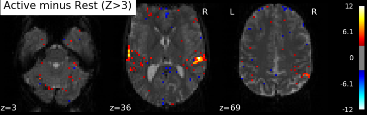 ../_images/example-spmZ_map.png