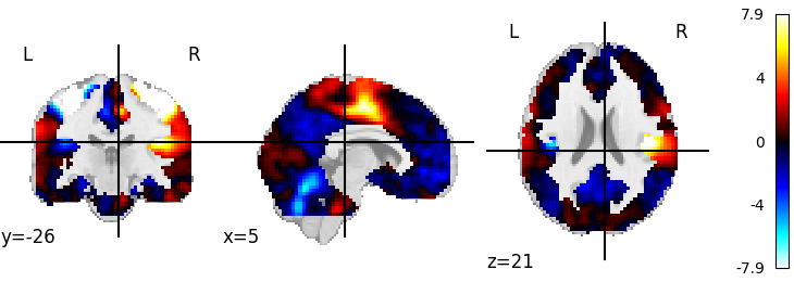 plot 3d and 4d niimg