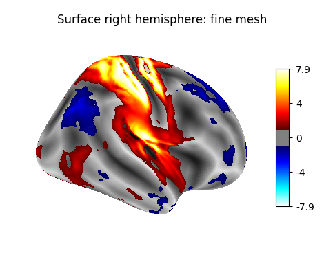 Surface right hemisphere: fine mesh