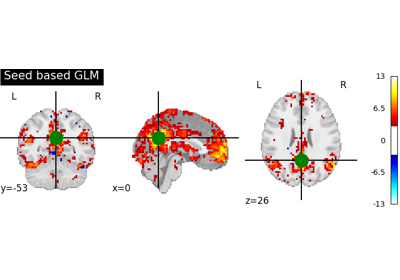 Default Mode Network extraction of AHDH dataset