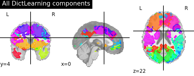 ../_images/sphx_glr_plot_compare_decomposition_022.png