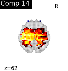 plot compare decomposition