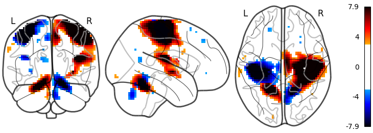 plot demo glass brain extensive