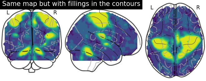 plot demo glass brain extensive