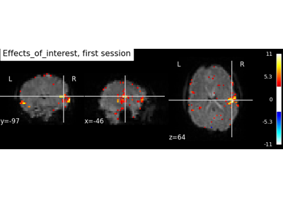 Simple example of two-session fMRI model fitting