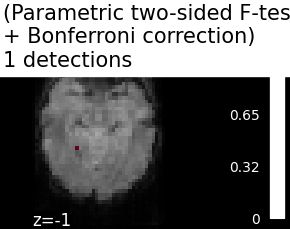 ../_images/sphx_glr_plot_haxby_mass_univariate_001.png