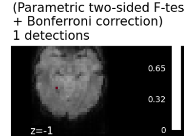 Massively univariate analysis of face vs house recognition