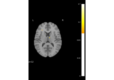 Massively univariate analysis of a motor task from the Localizer dataset