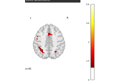 Massively univariate analysis of a calculation task from the Localizer dataset