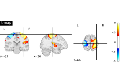 Negating an image with math_img